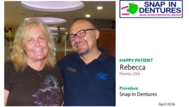 Snap in Dentures Cancun